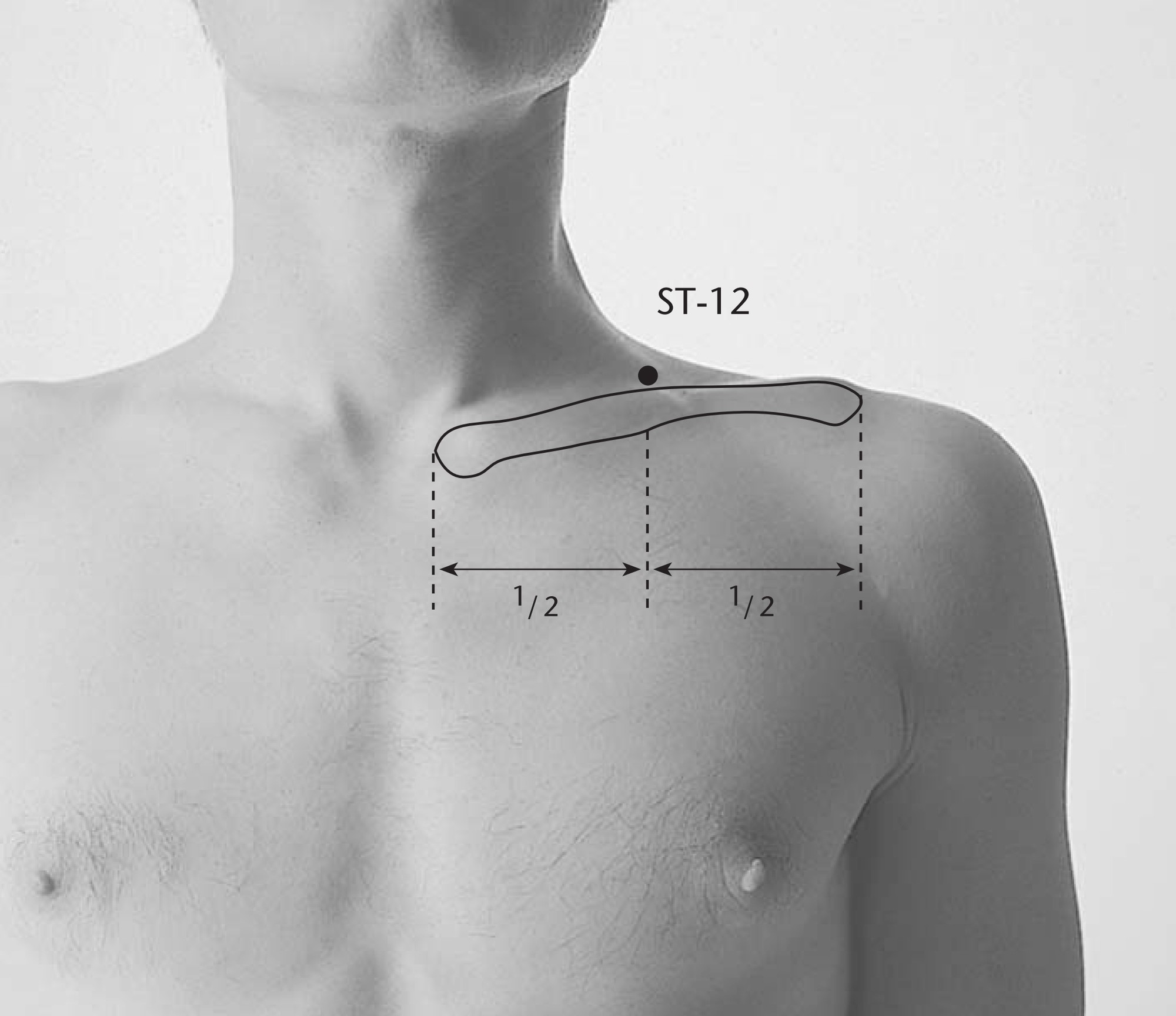 Площадь поверхности грудной клетки у человека. Цюэ Пэнь точка. Точка Тянь – Жун. E12 точка акупунктуры. Точка Цзюй Ляо.