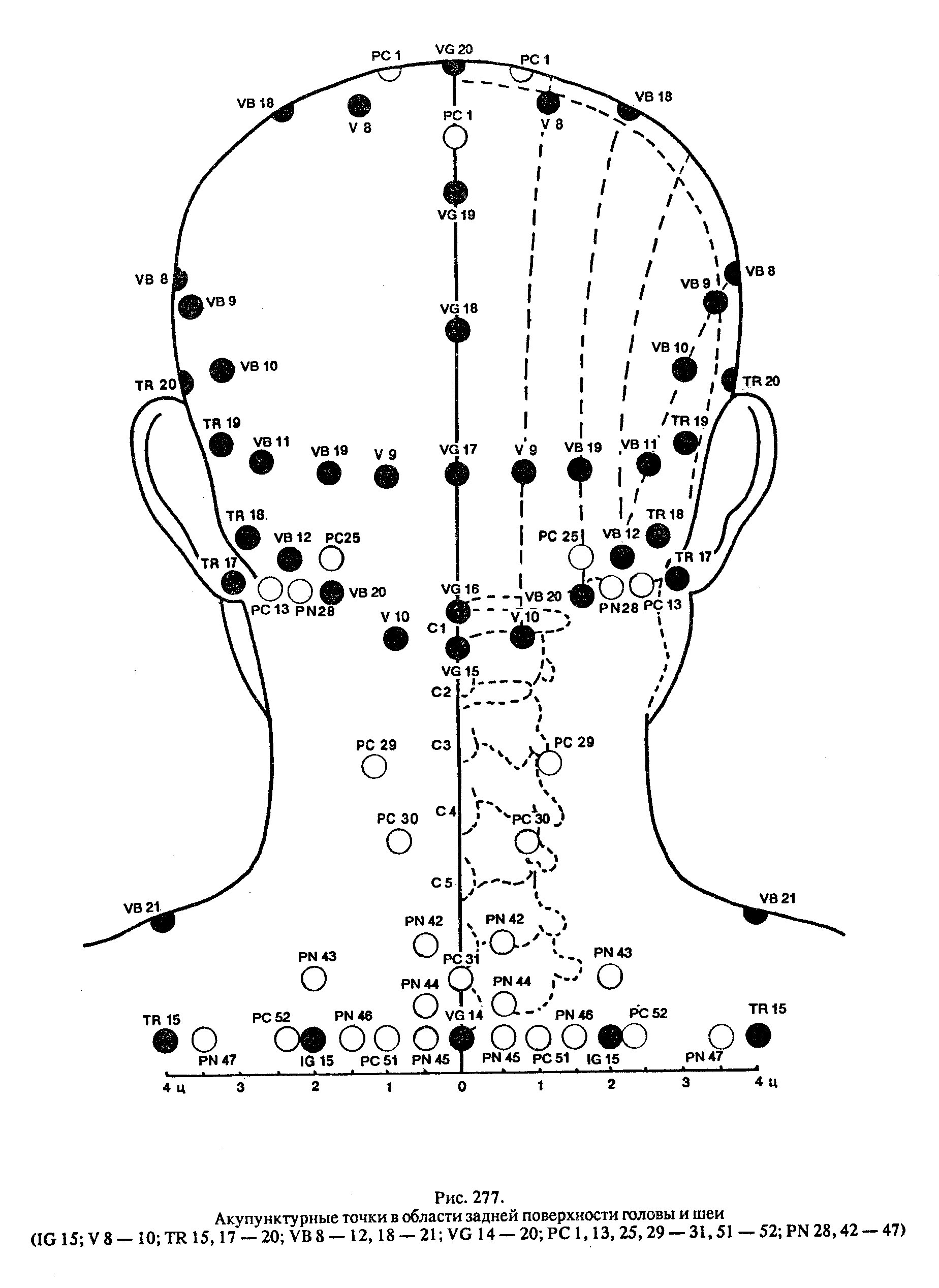 Точки на затылке. Акупунктурные точки головы схема. Акупунктура головы человека схема. Акупунктурные точки на голове человека атлас.